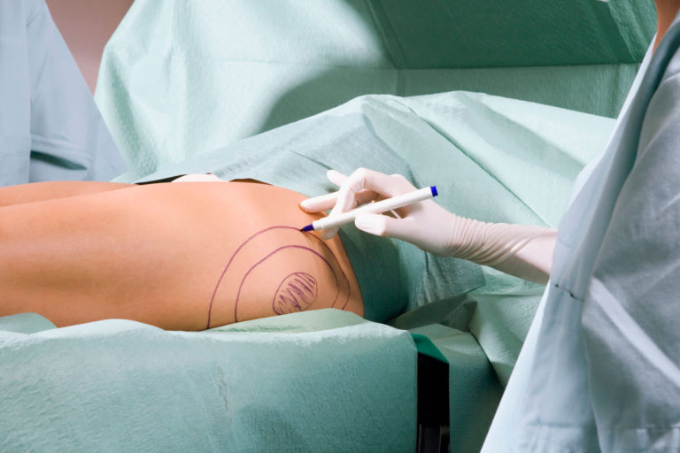 Cosmetic surgery is booming because of distant work and social media