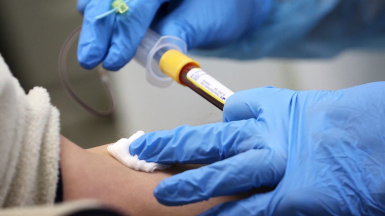 Not less than 58% of U.S. inhabitants has pure antibodies from earlier Covid an infection, CDC says